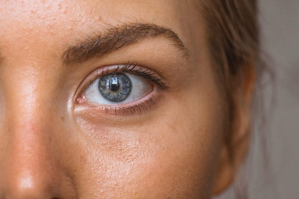 Bellow’s Why Treating Under Eye Bags with Filler Can Make Them Worse, According to Professionals