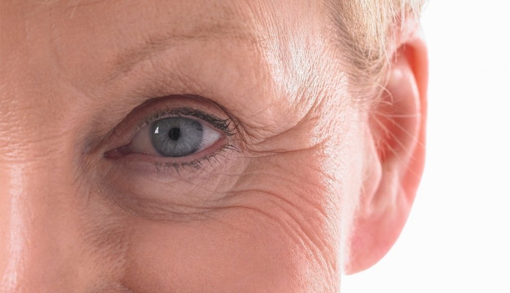 When to See Your Medical Professional After Blepharoplasty?
